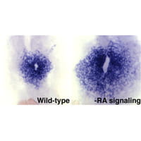 Embryos: wild-type versus inhibited RA signaling.
